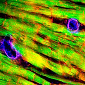 Heart tissue,fluorescence micrograph