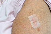 Drug patch for pain relief