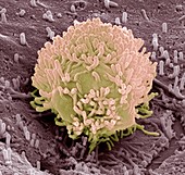 Colorectal cancer cell