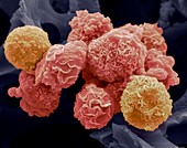 Cervical cancer cells,SEM