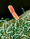 Shigella bacteria,SEM
