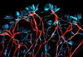 Rat neurons,fluorescence micrograph