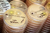 Petri dish cultures of E.coli bacteria