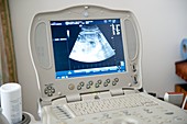 Pregnancy ultrasound scanning