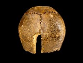 Neanderthal cranium