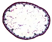 Common rush stem,light micrograph