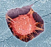 Osteoblast bone cell,SEM