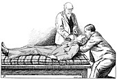 Resuscitation technique,19th century