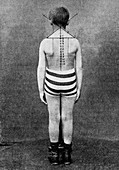 Posture in children,19th century