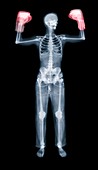 Boxer,X-ray