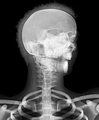 Human head,X-ray