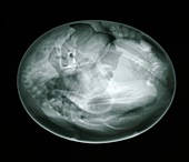 Bird egg and embryo,X-ray