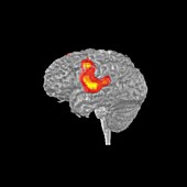 Brain activity during speech