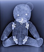 Teddy bear,X-ray