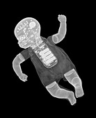 Toy baby,X-ray