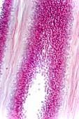 Boletus fungus,light micrograph