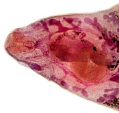 Beef liver fluke,light micrograph