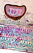 Rose mildew fungus,light micrograph