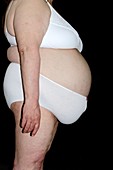 Obese woman in her underwear