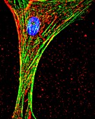 Parkinson's disease research