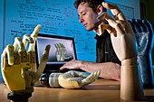 i-LIMB bionic hand research
