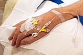 Chemotherapy for cancer patient