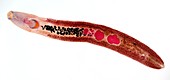 Fluke worm,light micrograph