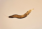 Threadworm,light micrograph