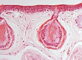 Frog skin glands,light micrograph
