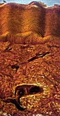 Human skin,light micrograph