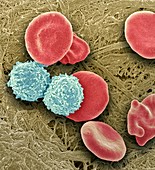 Leukaemia blood cells,SEM