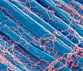 Optic nerve fibres,SEM