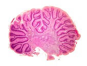 Cerebellum,light micrograph