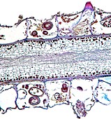 Bryozoa sea moss,light micrograph
