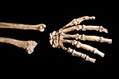 Australopithecus sediba fossil hand