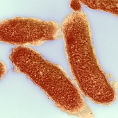 Cholera bacteria,TEM