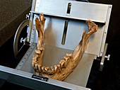 Neanderthal jaw bone,La Ferrassie 1