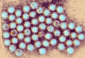 Norovirus particles,TEM