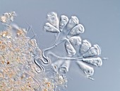 Peritrich protozoa,light micrograph
