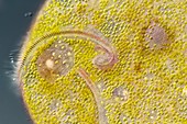 Ciliate protozoan,light micrograph