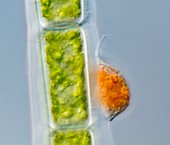 Diatom on green algae,light micrograph