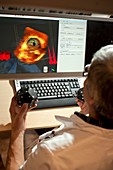 3D ultrasound cardiography