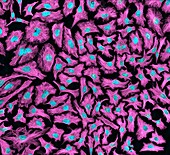 HeLa cells,light micrograph