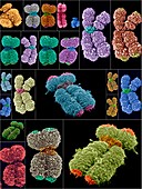 Human chromosomes,SEMs