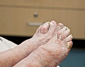 Elderly woman's feet