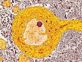 Purkinje nerve cell,TEM