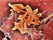 Macrophage engulfing TB bacteria,SEM