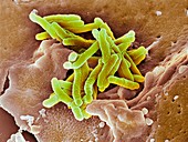 Macrophage engulfing TB bacteria,SEM