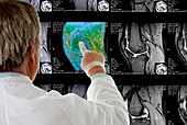 Radiologist examining knee MRI scans