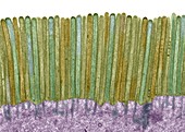 Intestinal microvilli,TEM